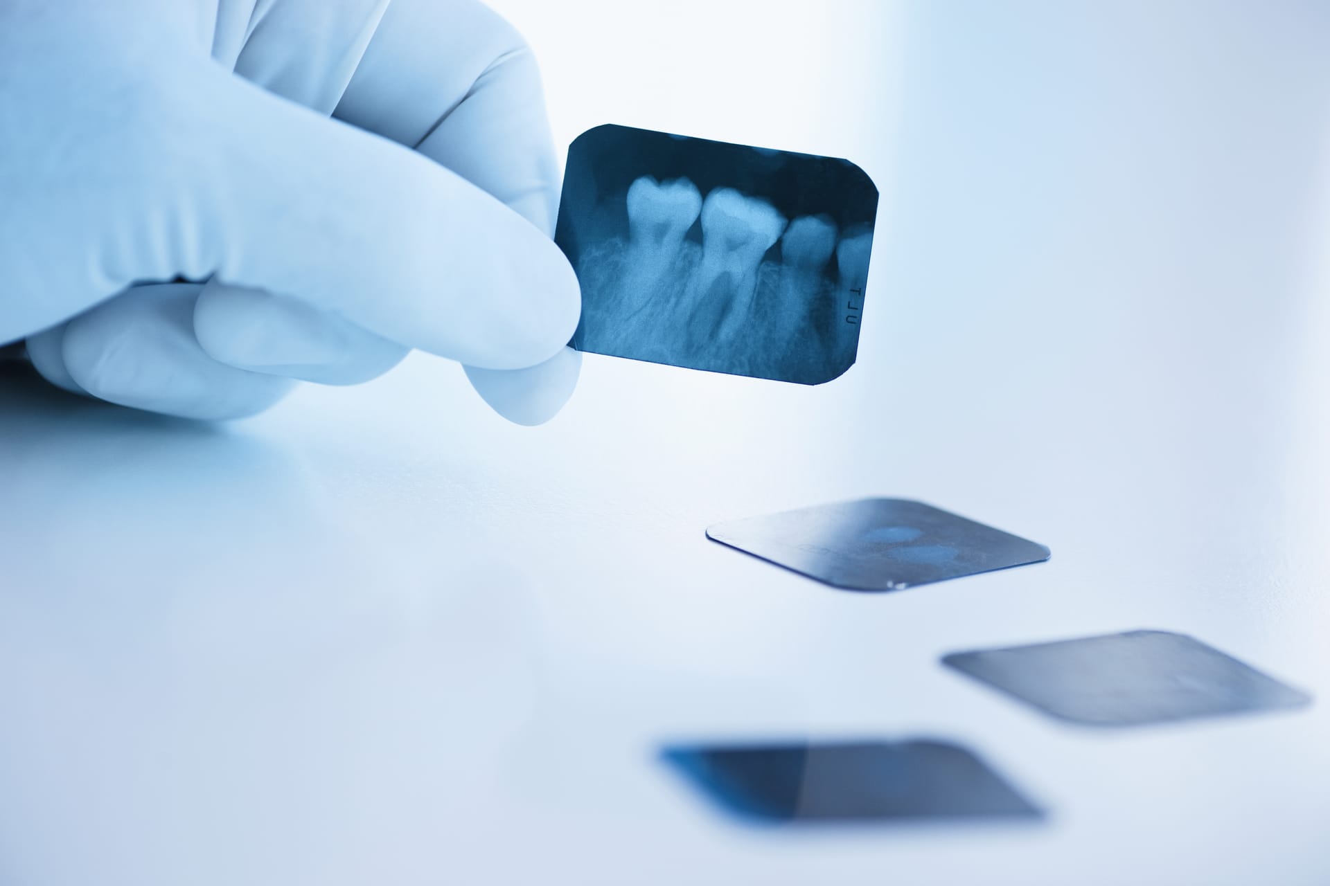 A dental x-ray shown on a light box